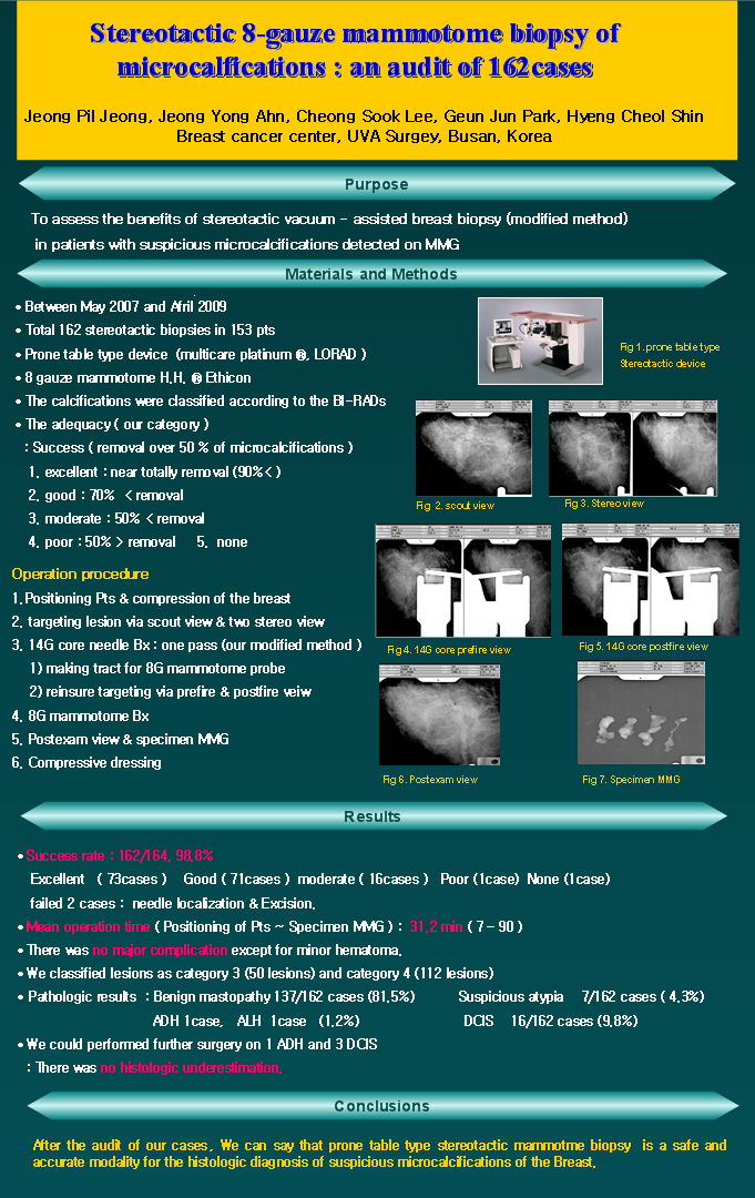 5. 2008 춘계 한국유방암학회 복와식 입체정위생검기기를 이용한 미세석회화 맘모톰 생검술.png