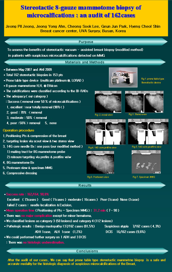 6. 2009 춘계 한국유방암학회 미세석회화의 입체정위맘모톰생검술 162례.png