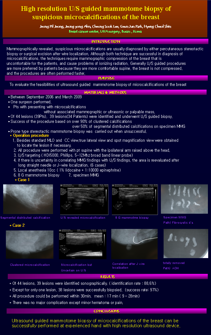7. 2009 춘계 한국유방암학회 고해상도 초음파 유도하 미세석회화 맘모톰생검술.png